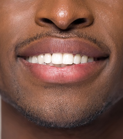 Whiter teeth are just one benefit of veneers in Dayton OH